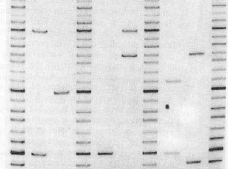 Sincliar DNA str
